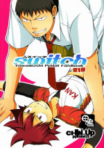 [CHIN-UP (Pocchi)] switch (Yowamushi Pedal)